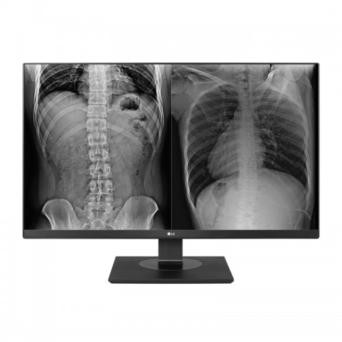 LG 27in 27HJ713C UHD IPS LED Clinical Monitor - 3840 x 2160 (16:9) / 5ms / 60Hz / VESA